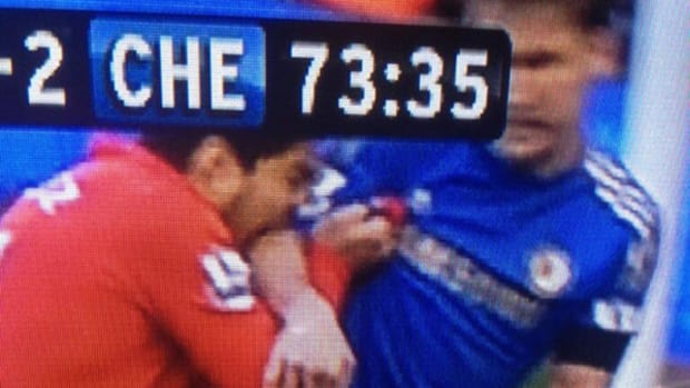suarez-bite-t1.jpg